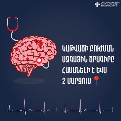 Կաթվածի բուժման ազգային ծրագիրը հասանելի է ևս երկու մարզում